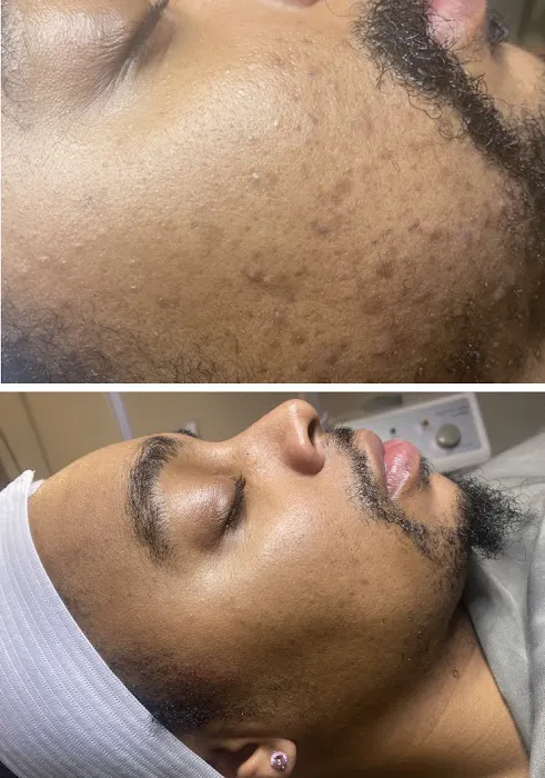 Skin Deep By Autumn Picture 1