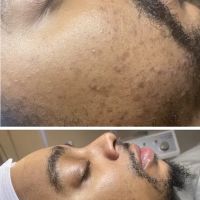 Skin Deep By Autumn ico