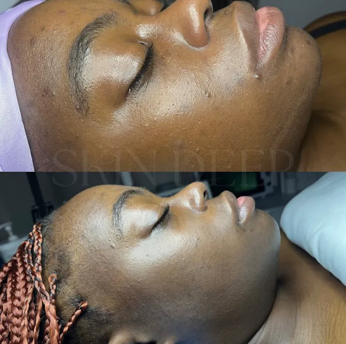 Skin Deep By Autumn Picture 5