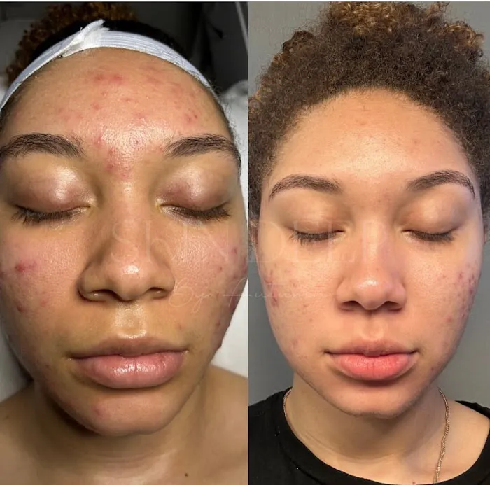 Skin Deep By Autumn Picture 6