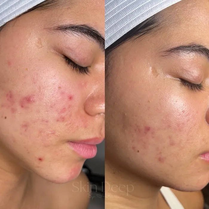 Skin Deep By Autumn Picture 7