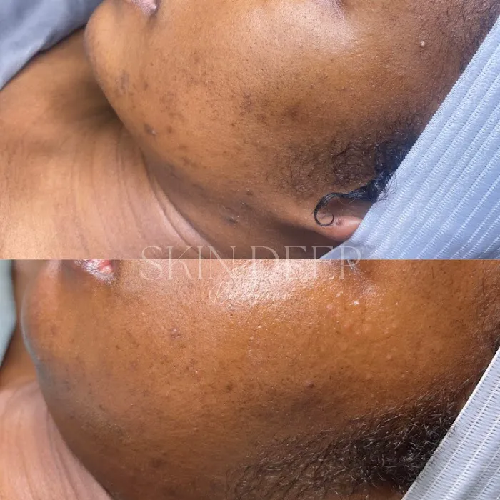 Skin Deep By Autumn Picture 4