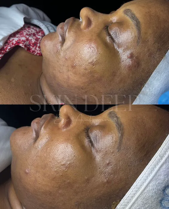 Skin Deep By Autumn Picture 8