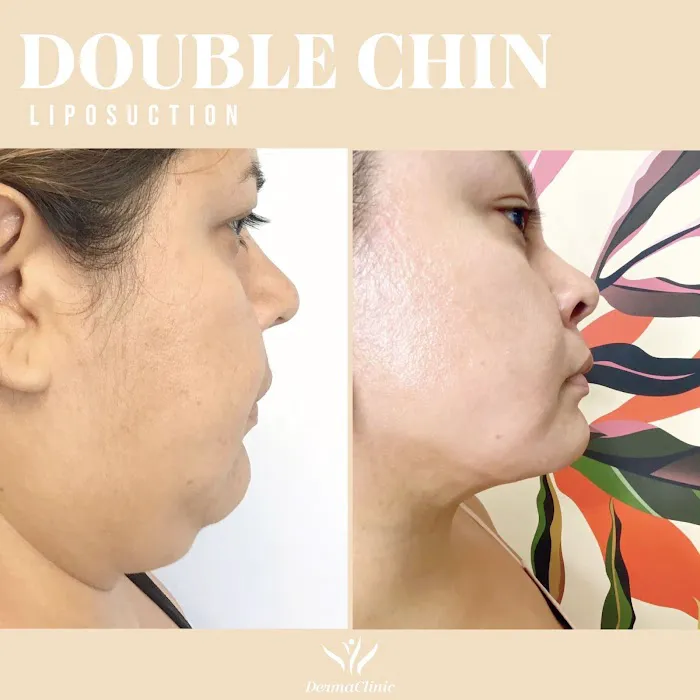 Dermaclinic Vegas Picture 6