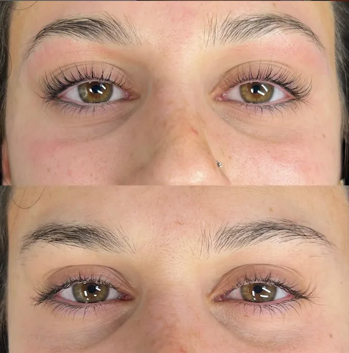 GloStudio Esthetics Picture 2