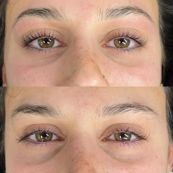 GloStudio Esthetics Picture 3