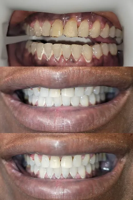 ADJ Aesthetics Picture 1