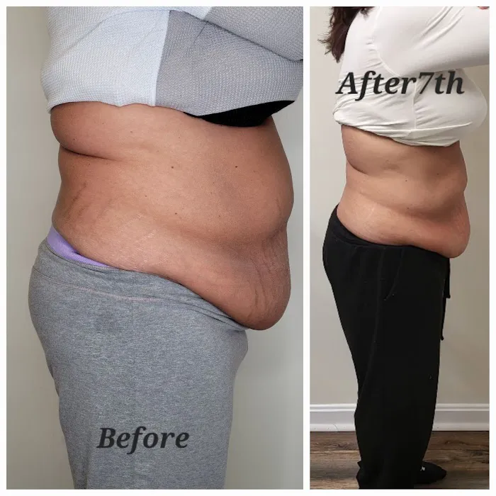 ADJ Aesthetics Picture 6