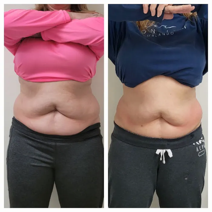 ADJ Aesthetics Picture 5