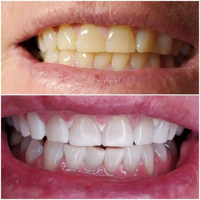 ADJ Aesthetics Picture 9