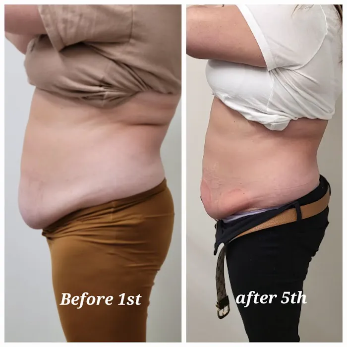 ADJ Aesthetics Picture 8