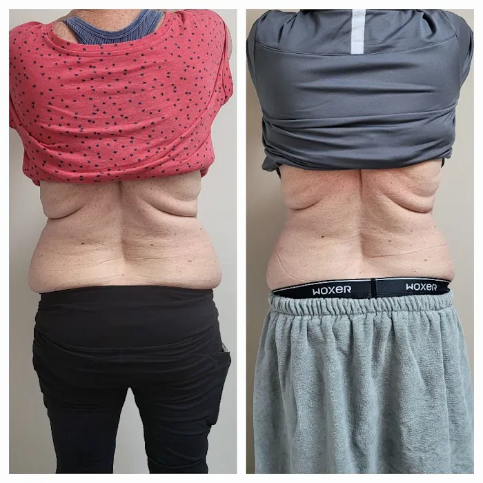 ADJ Aesthetics Picture 7