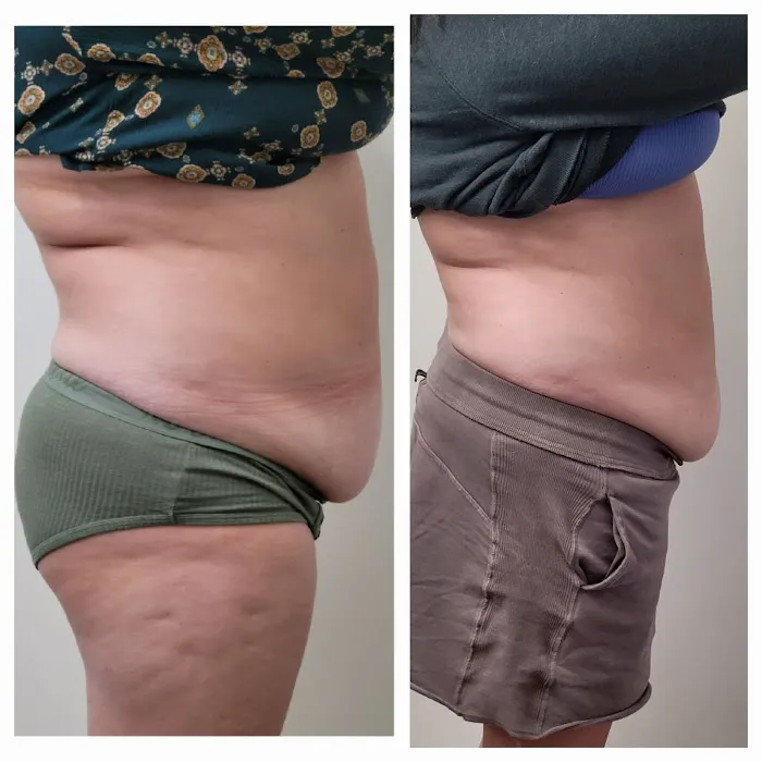 ADJ Aesthetics Picture 10