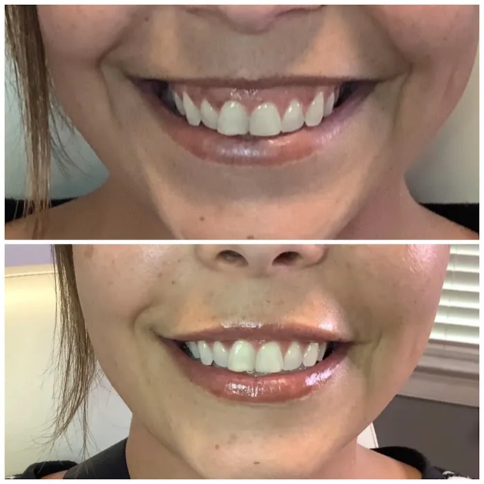 Skin Treats Picture 3