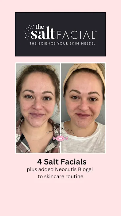 Skin Treats Picture 2