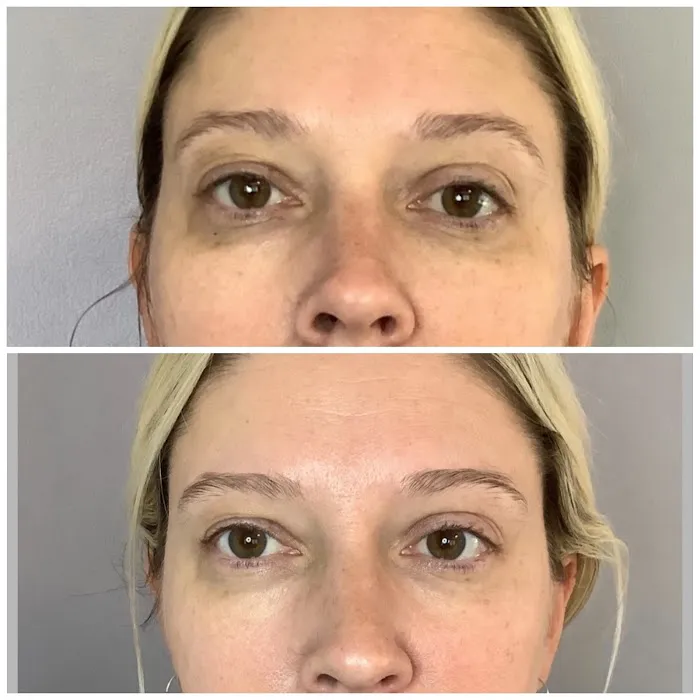 Skin Treats Picture 7