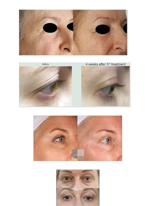 Skin Treats Picture 9