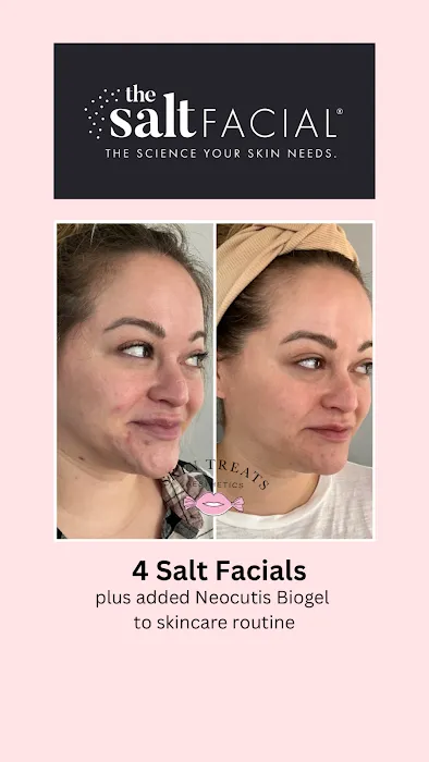 Skin Treats Picture 8