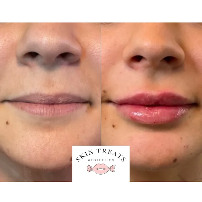 Skin Treats Picture 10