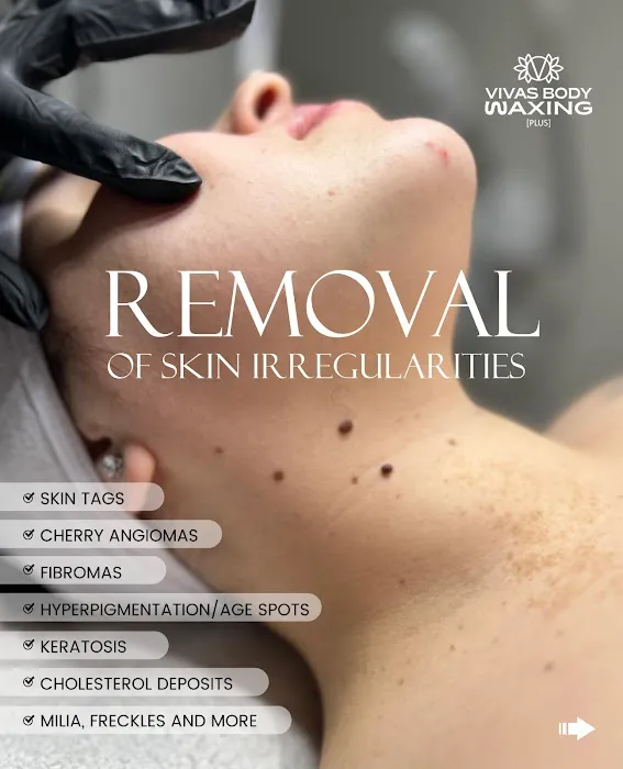 Vivas Body Waxing [PLUS] Picture 4