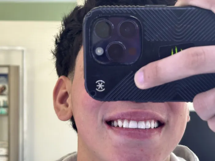 Vivas Body Waxing [PLUS] Picture 3