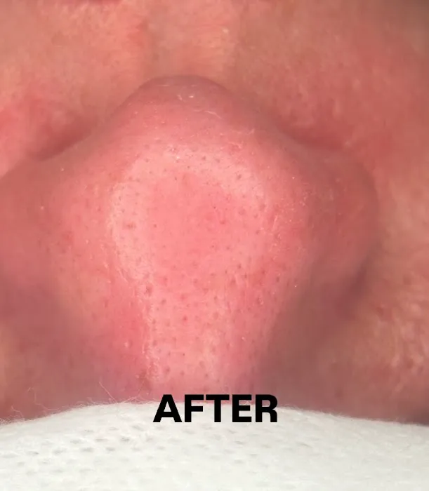 Bare Skin Haven Picture 1