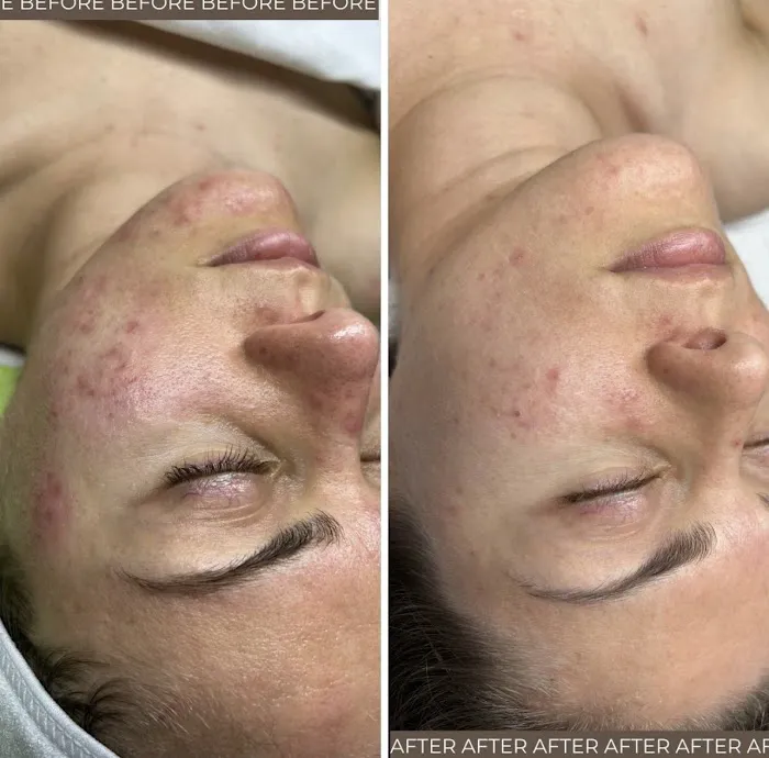 Face Me Aesthetics Picture 8