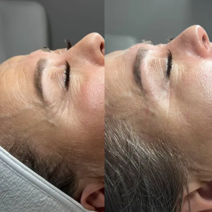 Face Me Aesthetics Picture 4