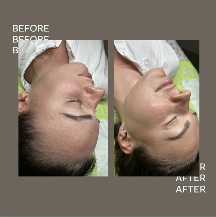 Face Me Aesthetics Picture 7