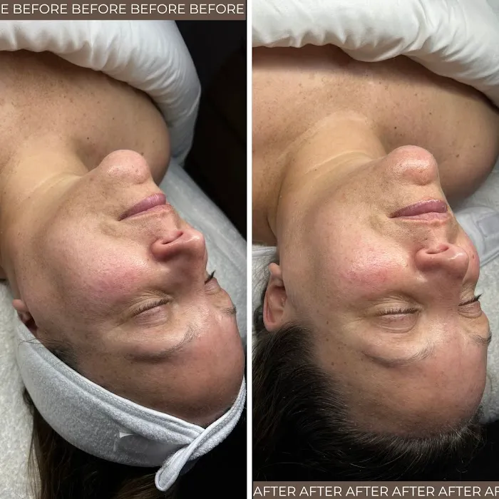 Face Me Aesthetics Picture 3