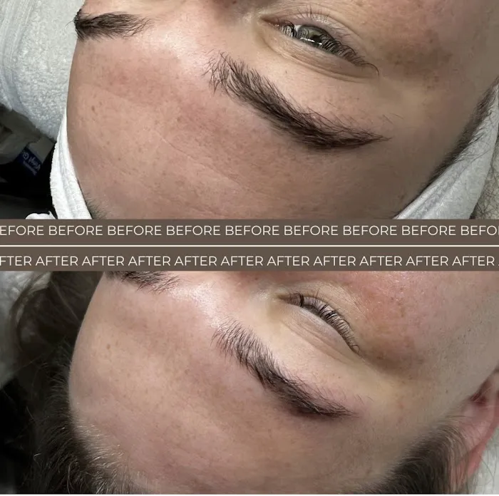 Face Me Aesthetics Picture 10