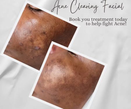 Flawless Skincare and Beauty