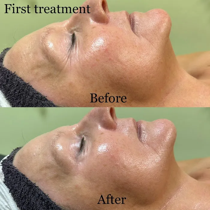 Bareskin beauty LLC Picture 7