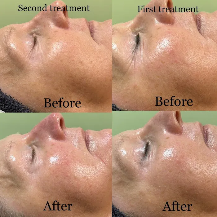 Bareskin beauty LLC Picture 1