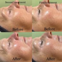 Bareskin beauty LLC ico