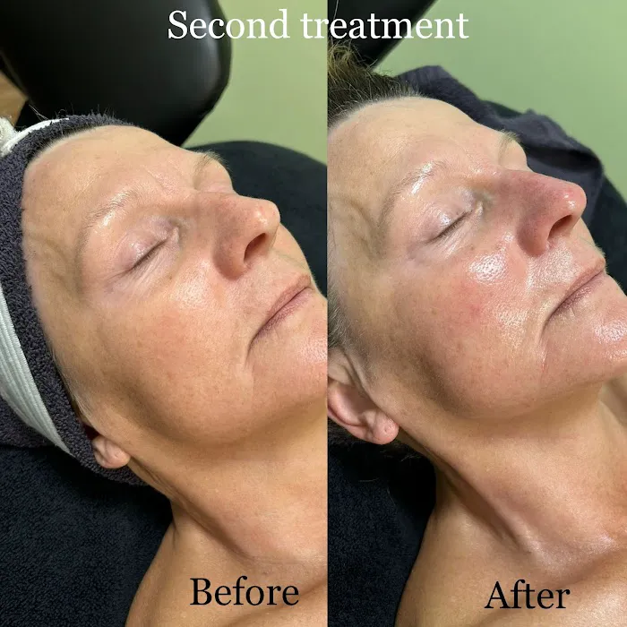 Bareskin beauty LLC Picture 2