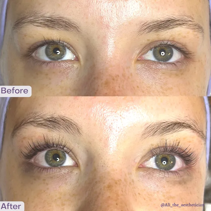 Beyond the Barrier Aesthetics LLC Picture 10