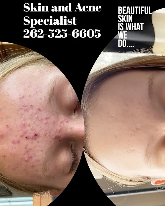 Skin and Acne Specialist & The Washington County School of Esthetics Picture 3
