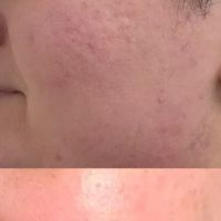 Becca Skin + Wellness ico