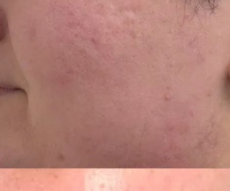 Becca Skin + Wellness