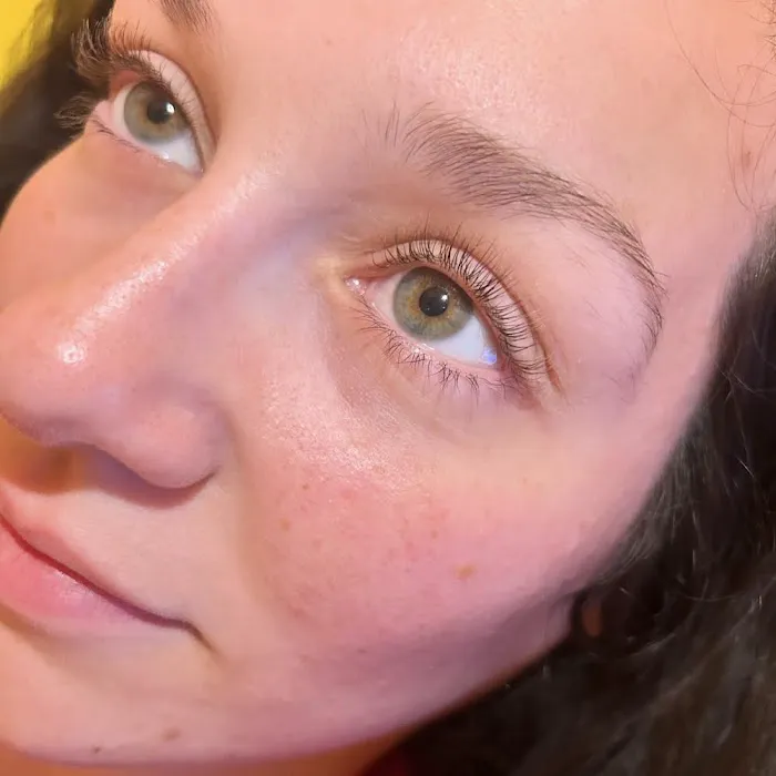 Love Esthetics Picture 8