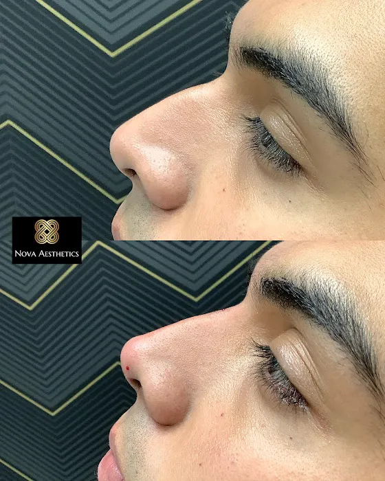 Nova Aesthetics Picture 10