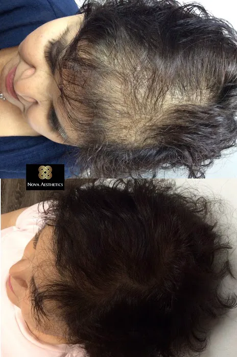 Nova Aesthetics Picture 9