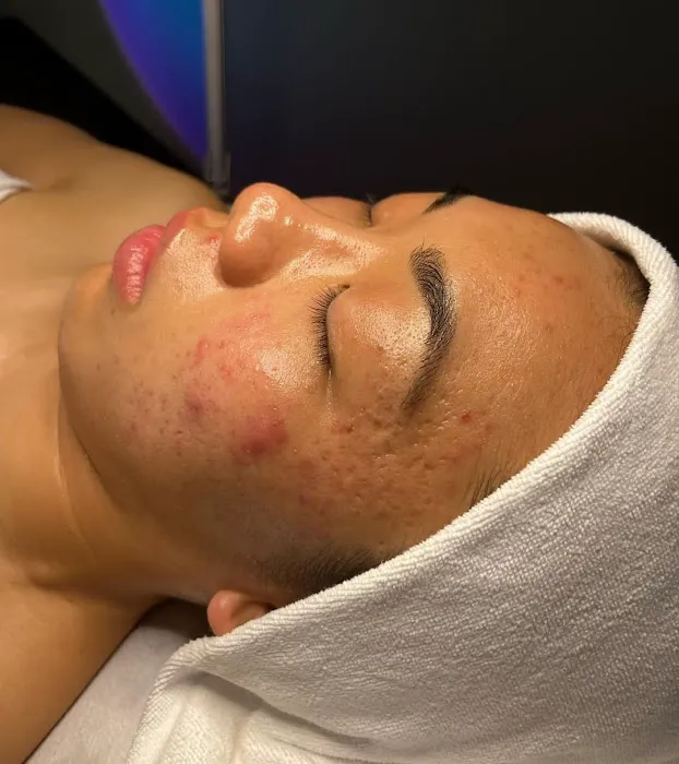 Surfaced Skin by Aponi Picture 1