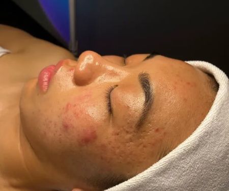 Surfaced Skin by Aponi