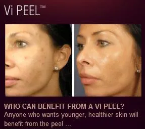 Facial Finesse Medical Aesthetics Picture 5