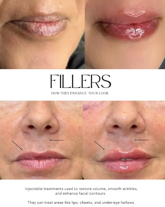 Premier Spa SKC Picture 7