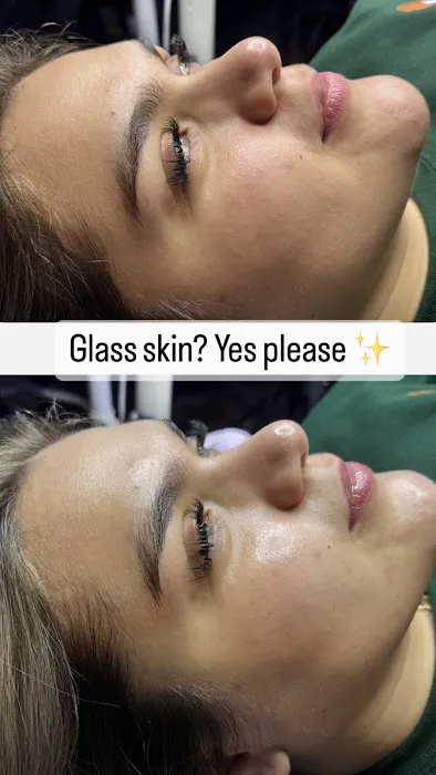 Bellskin Aesthetics Picture 4