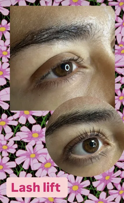 Bellskin Aesthetics Picture 5