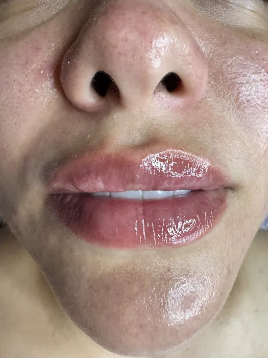 Bellskin Aesthetics Picture 8